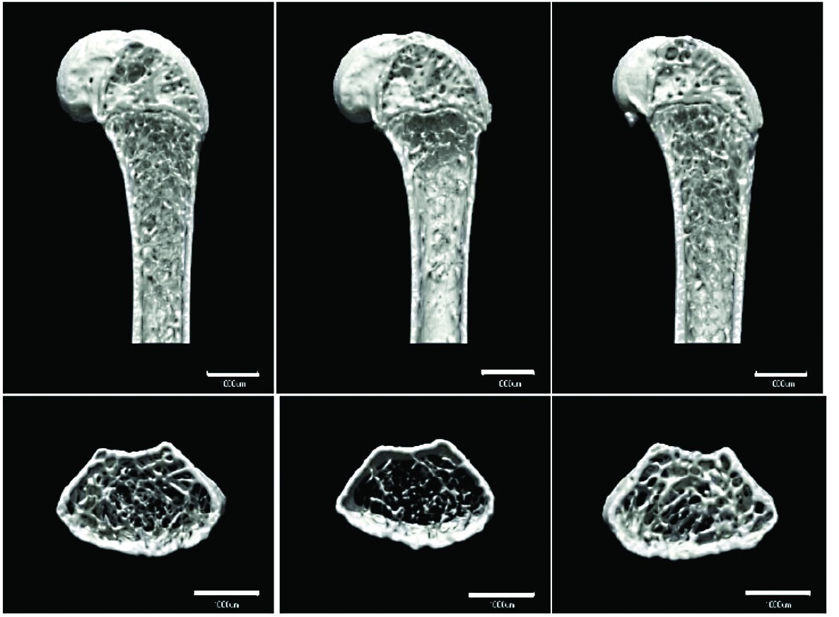 Astronauts may need to jump in space to fight bone loss